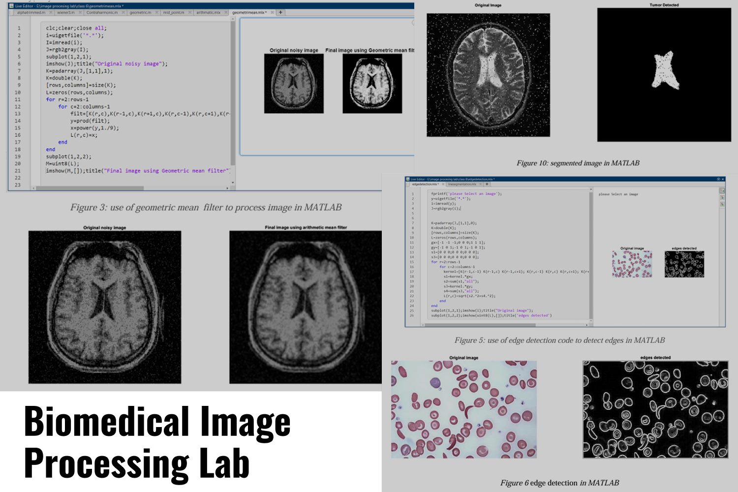 Biomedical image processing
